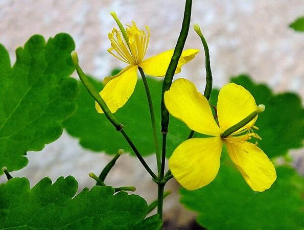 Celandine para el tratamiento de la psoriasis