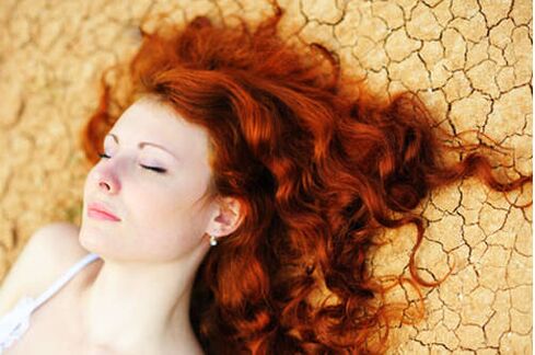 Chica con psoriasis