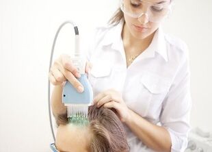 tratamientos para la psoriasis en la cabeza